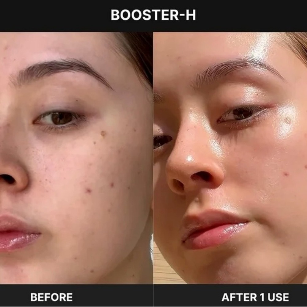 BRAND NEW‼️ MEDICUBE AGE-R BOOSTER HEALER - Picture 4 of 7